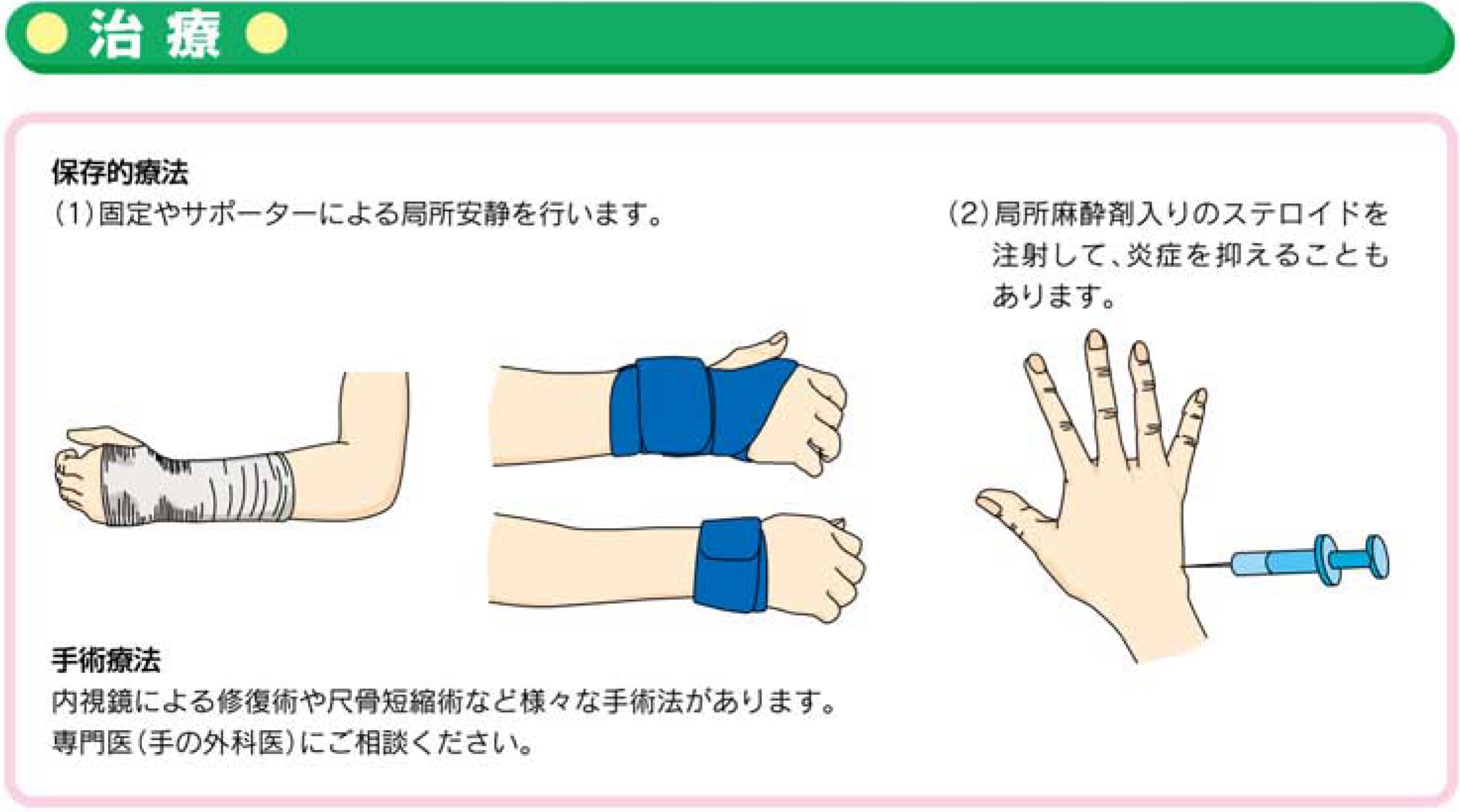 手関節tfcc損傷 お知らせ 溝口病院 救急指定病院 福岡